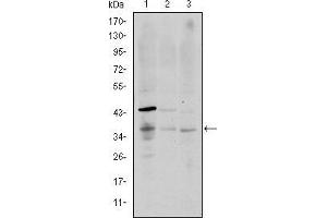 Western blot analysis using CD1A mouse mAb against K562 (1), RAJI (2), and MOLT4 (3) cell lysate. (CD1a antibody)