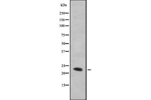 Western blot analysis GAAP using HepG2 whole cell lysates (TMBIM4 antibody  (N-Term))
