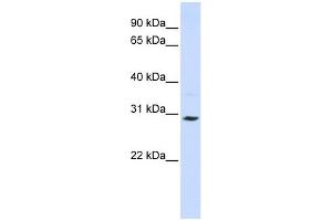 SLC25A20 antibody used at 1 ug/ml to detect target protein.