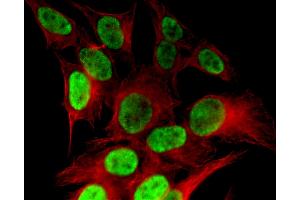 Histone H4K8ac antibody (pAb) tested by immunofluorescence. (Histone H4 antibody  (acLys8))