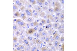 Immunohistochemistry of paraffin-embedded mouse liver using EPHX1 antibody at dilution of 1:100 (400x lens).