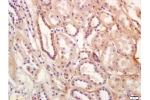 Formalin-fixed and paraffin embedded human kidney labeled with Anti-SLC12A3 Polyclonal Antibody, Unconjugated (ABIN872340) at 1:200 followed by conjugation to the secondary antibody and DAB staining (SLC12A3 antibody  (AA 951-1021))