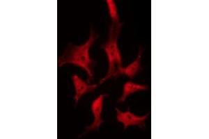 ABIN6268771 staining 293 by IF/ICC. (TYK2 antibody  (C-Term))