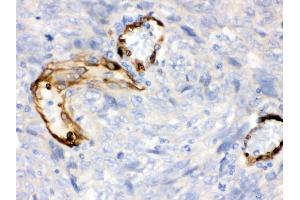 Immunohistochemistry (Paraffin-embedded Sections) (IHC (p)) image for anti-Indoleamine 2,3-Dioxygenase 1 (IDO1) (AA 37-69), (N-Term) antibody (ABIN3043857) (IDO1 antibody  (N-Term))