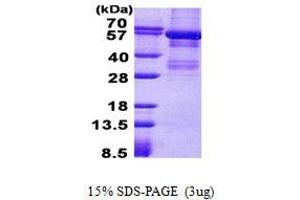 Image no. 1 for V-Yes-1 Yamaguchi Sarcoma Viral Related Oncogene Homolog (LYN) protein (His tag) (ABIN1098750)