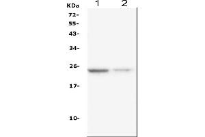 Western blot analysis of IL22 using anti-IL22 antibody (ABIN6719333).