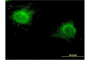 Immunofluorescence of monoclonal antibody to ZNF239 on HeLa cell.