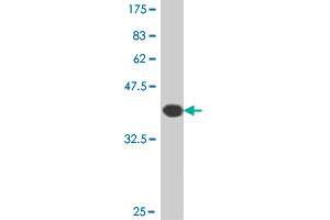 Western Blot detection against Immunogen (38. (NFAT1 antibody  (AA 812-921))