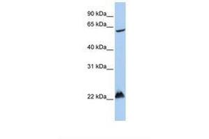 Image no. 1 for anti-Mahogunin, Ring Finger 1 (MGRN1) (AA 252-301) antibody (ABIN6738063) (Mahogunin RING Finger Protein 1 antibody  (AA 252-301))