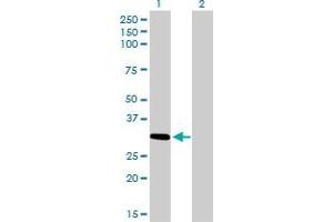 Western Blot analysis of ZNF124 expression in transfected 293T cell line by ZNF124 monoclonal antibody (M01), clone 4G4.