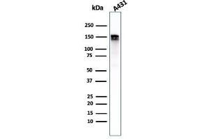 Western Blot Analysis of A431 cell lysate using EGFR-Monospecific Recombinant Rabbit Monoclonal Antibody (GFR/2968R). (Recombinant EGFR antibody)