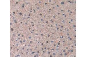 Used in DAB staining on fromalin fixed paraffin- embedded Kidney tissue (LIG1 antibody  (AA 484-663))