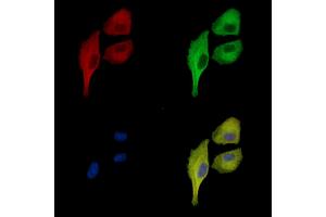 ABIN7096996 and ABIN7101063 staining  cells by IF/ICC.