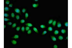 Immunofluorescent analysis of A549 cells using ABIN7154893 at dilution of 1:100 and Alexa Fluor 488-congugated AffiniPure Goat Anti-Rabbit IgG(H+L) (HSF2 antibody  (AA 79-173))