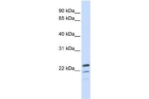 WB Suggested Anti-REEP1 Antibody Titration:  0. (Receptor Accessory Protein 1 antibody  (Middle Region))