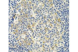 Immunohistochemistry of paraffin-embedded Human amygdalitis using DDX20 Polyclonal Antibody at dilution of 1:100 (40x lens). (DDX20 antibody)