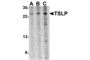 Western blot analysis of TSLP in A-20 cell lysate with TSLP antibody at (A) 0. (Thymic Stromal Lymphopoietin antibody)
