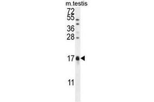 CAMK2N1 Antibody (C-term) western blot analysis in mouse testis tissue lysates (35µg/lane). (CAMK2N1 antibody  (C-Term))