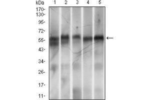 Western Blotting (WB) image for anti-Ring Finger Protein 1 (RING1) (AA 79-263) antibody (ABIN1845880) (RING1 antibody  (AA 79-263))