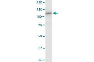 HIP1R MaxPab polyclonal antibody. (HIP1R antibody  (AA 1-1068))