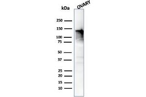 Western Blot Analysis of human Ovary tissue using Caldesmon Mouse Monoclonal Antibody (h-CALD). (Caldesmon antibody)