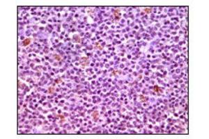 Immunohistochemistry (IHC) image for anti-Induced Myeloid Leukemia Cell Differentiation Protein Mcl-1 (MCL1) antibody (ABIN1844302) (MCL-1 antibody)