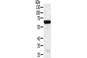 Western Blotting (WB) image for anti-TNF Receptor-Associated Factor 5 (TRAF5) antibody (ABIN5543831) (TRAF5 antibody)