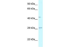 WB Suggested Anti-FUT8 Antibody Titration: 1. (FUT8 antibody  (N-Term))