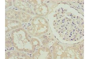 Immunohistochemistry of paraffin-embedded human kidney tissue using ABIN7170448 at dilution of 1:100 (SPACA1 antibody  (AA 30-221))