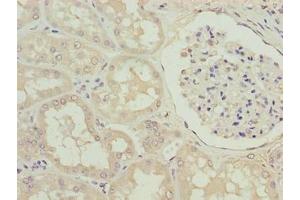 Immunohistochemistry of paraffin-embedded human kidney tissue using ABIN7170448 at dilution of 1:100