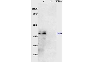 Lane 1: mouse kidney lysates Lane 2: mouse lung lysates probed with Anti AVPR2 Polyclonal Antibody, Unconjugated (ABIN747848) at 1:200 in 4 °C. (IL10RB antibody  (AA 21-120))