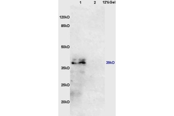IL10RB Antikörper  (AA 21-120)