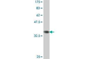 Western Blot detection against Immunogen (34. (GLTSCR2 antibody  (AA 402-478))