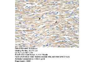 Rabbit Anti-LMX1A Antibody  Paraffin Embedded Tissue: Human Muscle Cellular Data: Skeletal muscle cells Antibody Concentration: 4. (LMX1A antibody  (Middle Region))