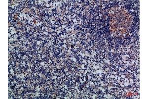 Immunohistochemical analysis of paraffin-embedded Human-lymph, antibody was diluted at 1:100 (GZMM antibody  (AA 207-256))