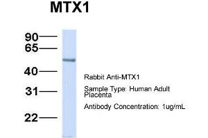 Host:  Rabbit  Target Name:  MTX1  Sample Type:  Human Adult Placenta  Antibody Dilution:  1. (Metaxin 1 antibody  (C-Term))