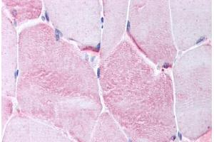 Human Skeletal Muscle (formalin-fixed, paraffin-embedded) stained with CACNG1 antibody ABIN214733 at 10 ug/ml followed by biotinylated goat anti-rabbit IgG secondary antibody ABIN481713, alkaline phosphatase-streptavidin and chromogen. (CACNG1 antibody  (AA 66-115))