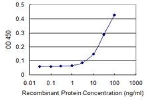 Detection limit for recombinant GST tagged TUBB is 1 ng/ml as a capture antibody. (TUBB antibody  (AA 1-444))