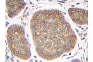 Image no. 1 for anti-Tumor Necrosis Factor (Ligand) Superfamily, Member 13 (TNFSF13) antibody (ABIN465417) (TNFSF13 antibody)
