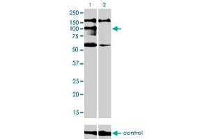 Western blot analysis of NBR1 over-expressed 293 cell line, cotransfected with NBR1 Validated Chimera RNAi (Lane 2) or non-transfected control (Lane 1).