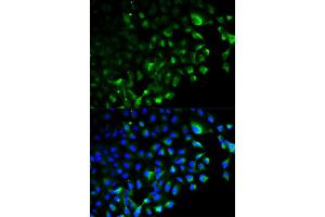 Immunofluorescence analysis of HeLa cell using TRAF2 antibody. (TRAF2 antibody)