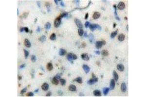 Used in DAB staining on fromalin fixed paraffin-embedded Stomach tissue (Nuclear Factor kappa B2 (AA 38-343) antibody)