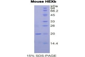 SDS-PAGE analysis of Mouse Hexosaminidase B beta Protein.