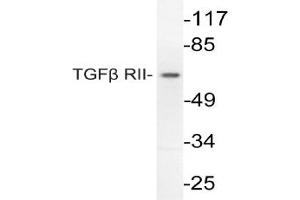Image no. 1 for anti-Transforming Growth Factor, beta Receptor II (70/80kDa) (TGFBR2) antibody (ABIN271848)