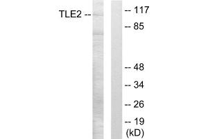 Western blot analysis of extracts from LOVO cells, using TLE2 antibody. (TLE2 antibody  (Internal Region))