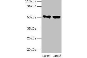 Western blot All lanes: KRT8 antibody at 2 μg/mL Lane 1: A549 whole cell lysate Lane 2: MCF-7 whole cell lysate Secondary Goat polyclonal to rabbit IgG at 1/10000 dilution Predicted band size: 54, 57 kDa Observed band size: 54 kDa (KRT8 antibody  (AA 2-483))