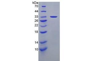 LAMA3 Protein