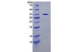 SDS-PAGE analysis of Human Laminin alpha 3 Protein.