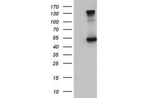 HEK293T cells were transfected with the pCMV6-ENTRY control (Left lane) or pCMV6-ENTRY EFEMP1 (Right lane) cDNA for 48 hrs and lysed. (FBLN3 antibody)