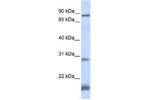 SMYD4 antibody used at 0. (SMYD4 antibody  (N-Term))